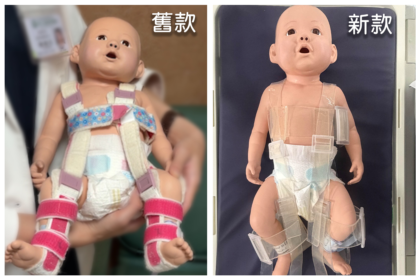 新款矯具採用高透光材料（右），免拆除即可同步進行黃疸光療，解決舊款（左）不透光之痛點。(彰基提供)